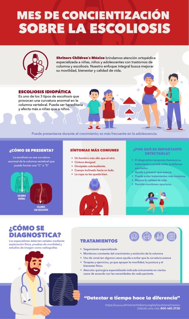 infografía escoliosis
