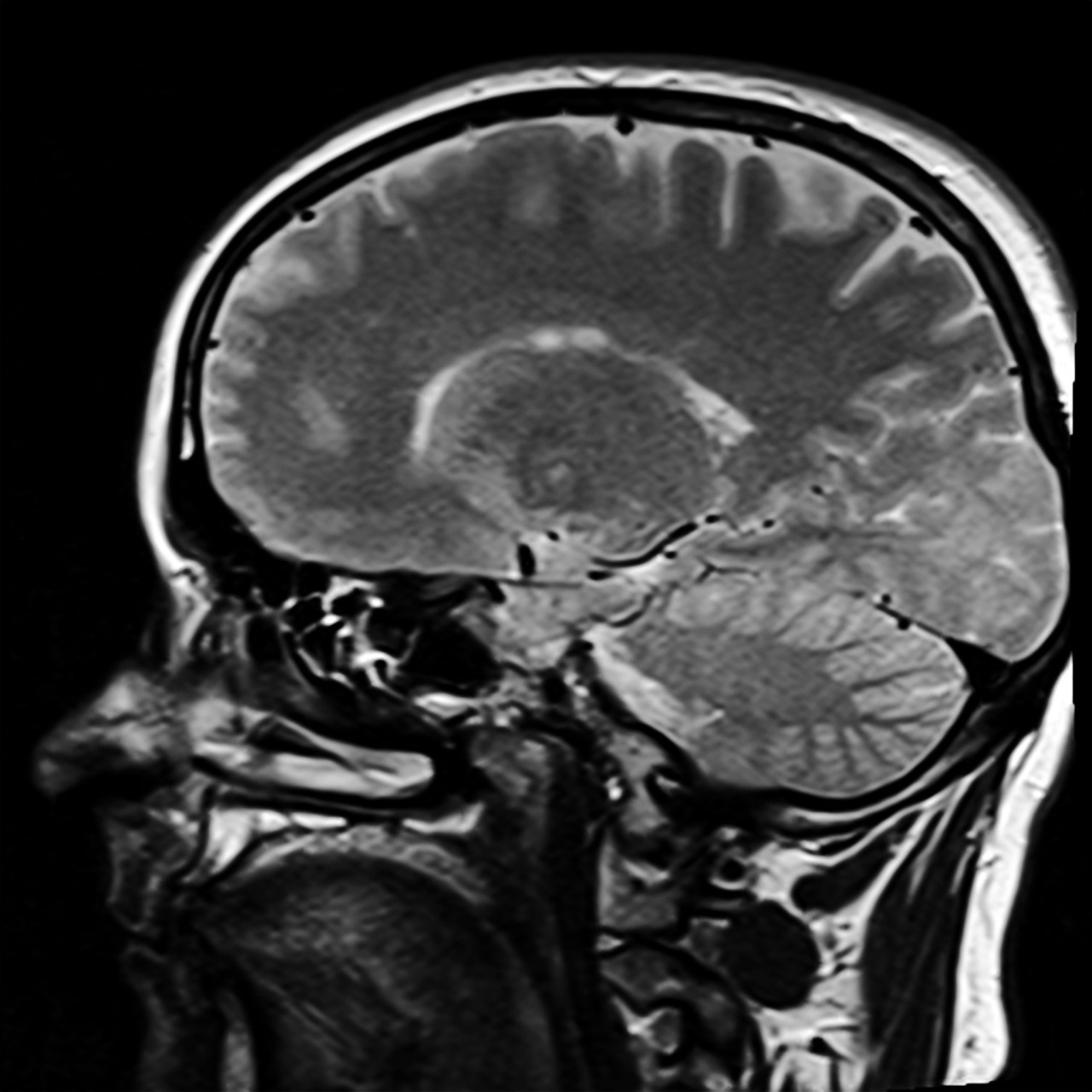 head, magnetic resonance imaging, mrt, roentgen, x-ray image, brain, mrt, mrt, roentgen, brain, brain, brain, brain, brain